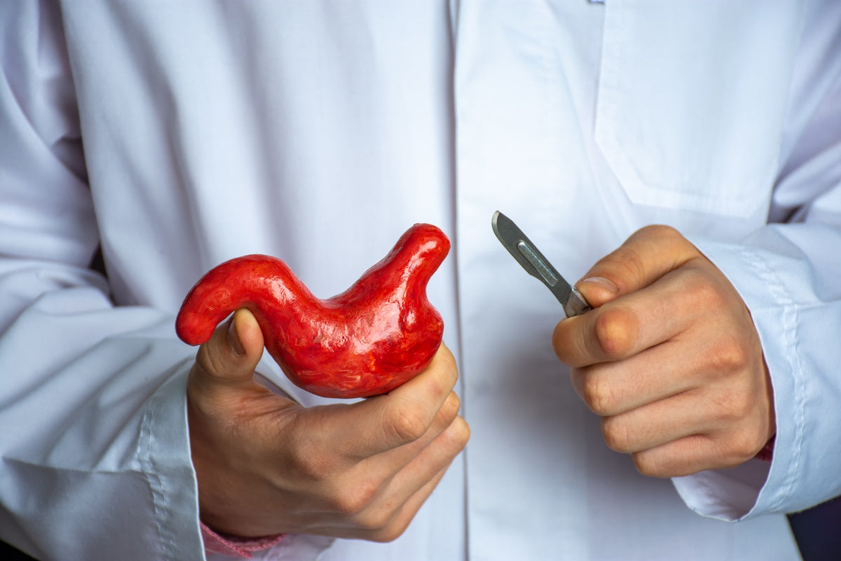 bariatric surgery definition